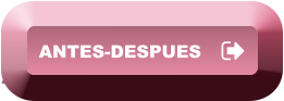 ANTES-DESPUES ANTES-DESPUES